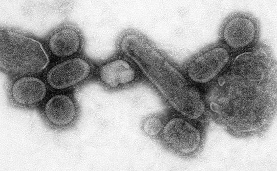 Rekonstruktion des Virus der Spanischen Grippe 1918/19 nach Infektion einer Zellkultur | Generationengespräch Rekonstruktion des Virus der Spanischen Grippe 1918/19 nach Infektion einer Zellkultur